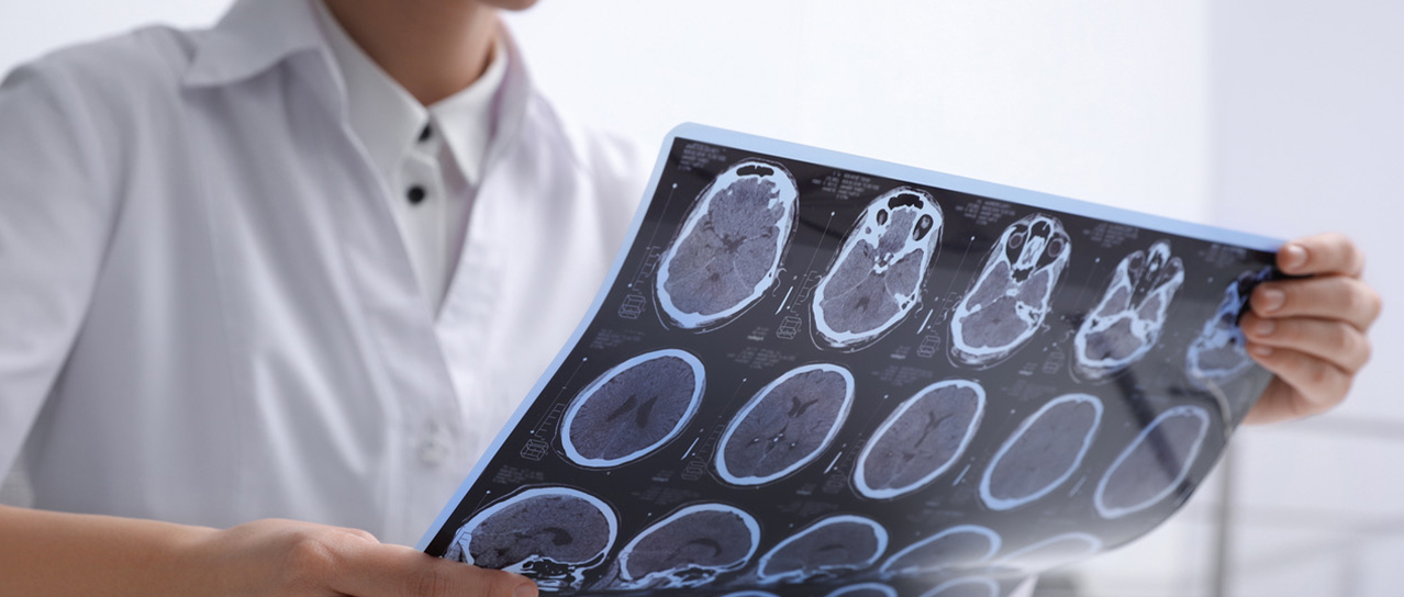 MRI images of patient with multiple sclerosis (Symbolic image: Adobe Stock)
